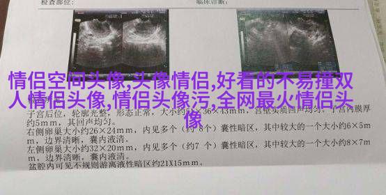 情人节怼情侣的头像(优选24张)